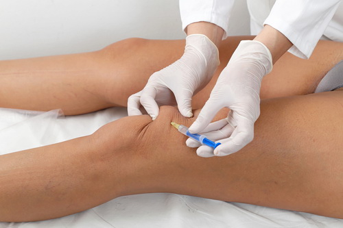 prolotherapy