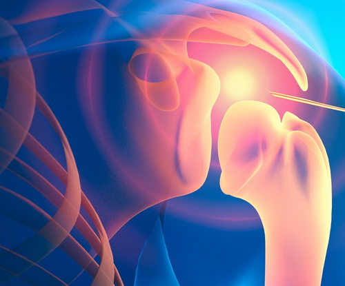 joint pain